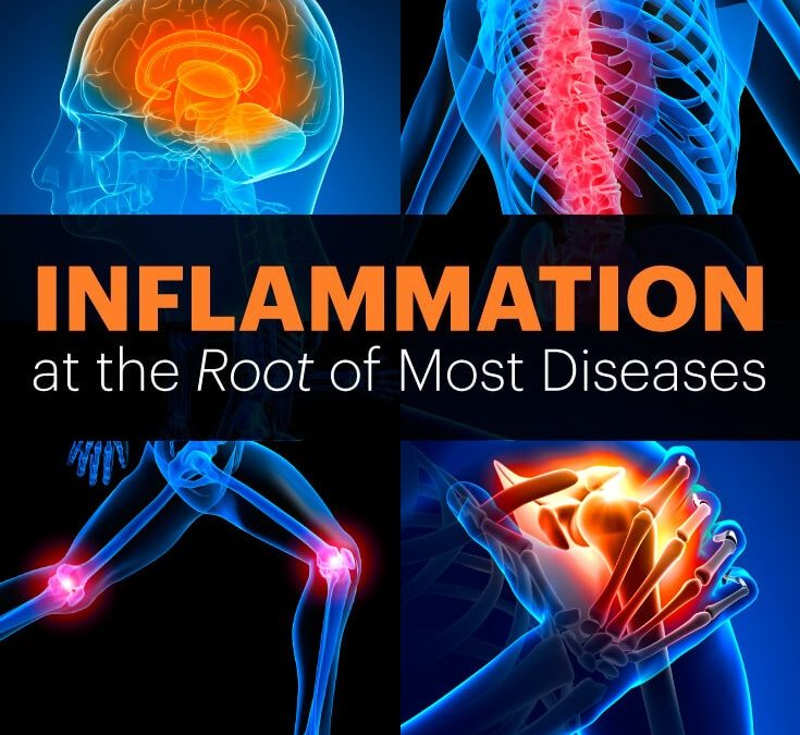 What Is Chronic Inflammation?